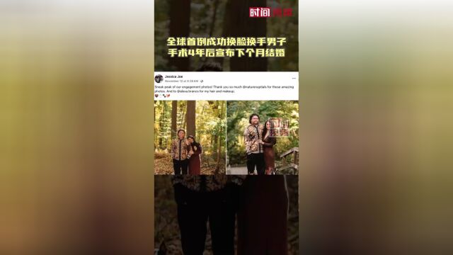 全球首位换脸换手男子步入婚姻殿堂，奇迹见证真爱