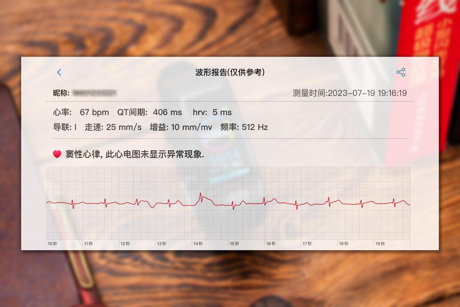 智能穿戴设备在健康监测领域的核心作用