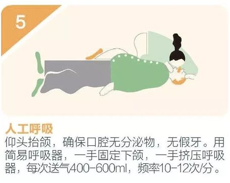 心肺复苏术（CPR）家庭急救指南